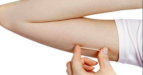 Is Nexplanon contraceptive implant safe for breastfeeding moms ...